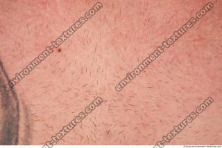 Photo Textures of Human Skin